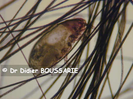 chirodiscoides caviae Adulte femelle vue latérale